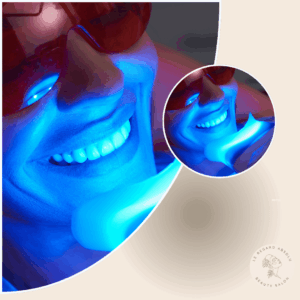 Blanchiment Dentaire